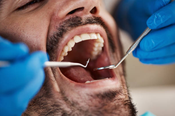 Best Same-Day Emergency Dentist in Mulgee, OK