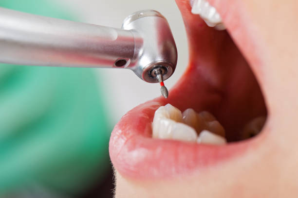 Best Walk-In Emergency Dentist in Mulgee, OK